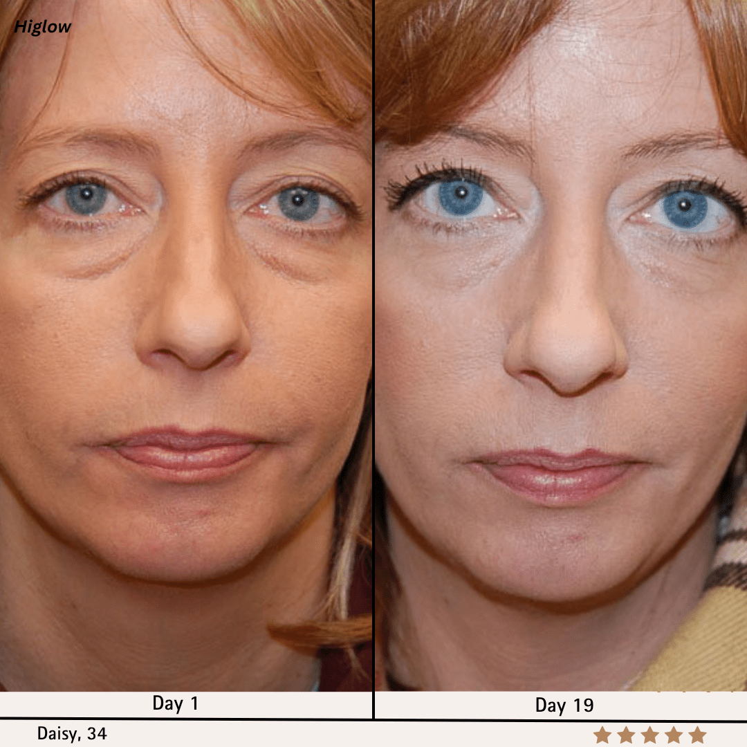 Higlow Peptide Eye Patch - My Store