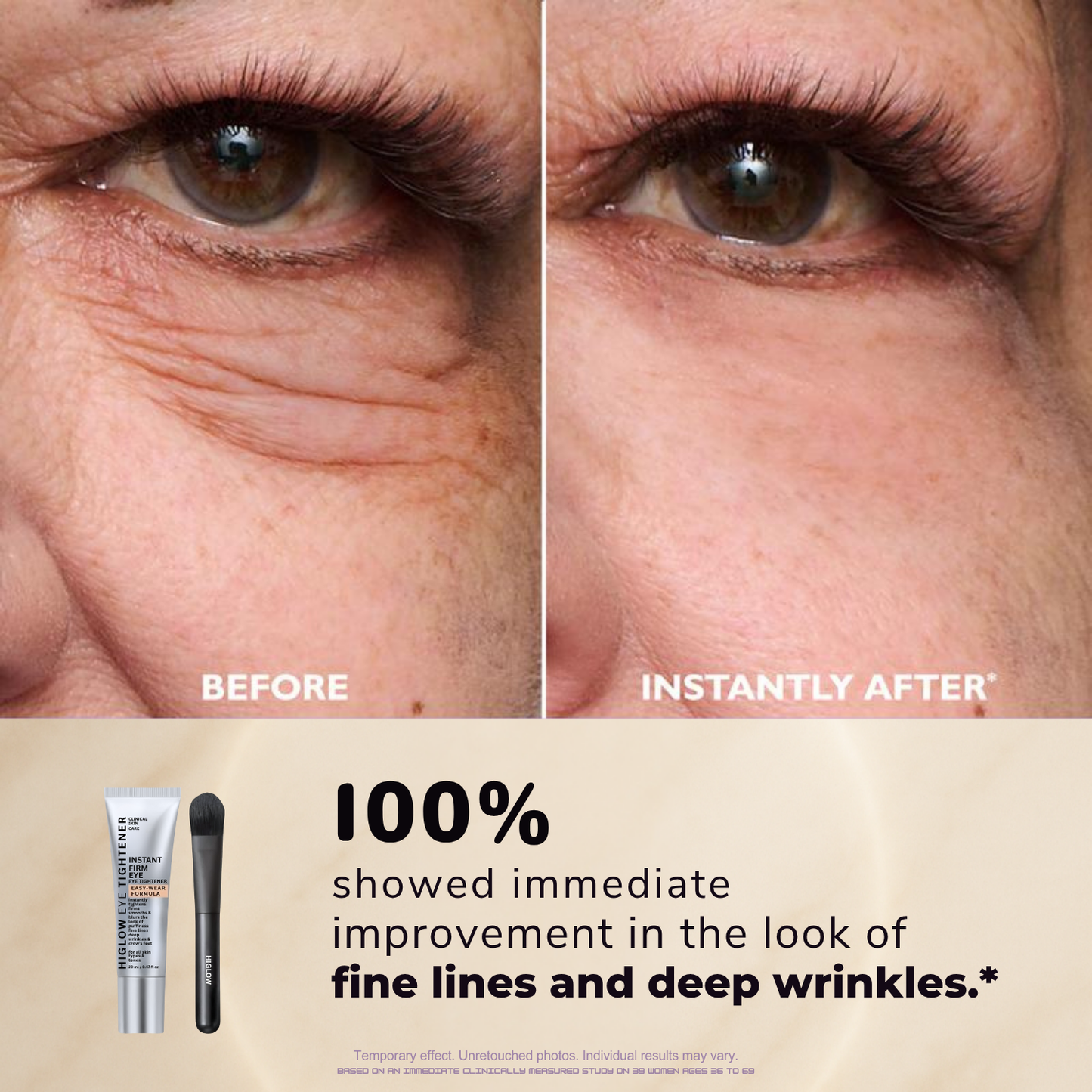 FirmX™ Eye Tightener