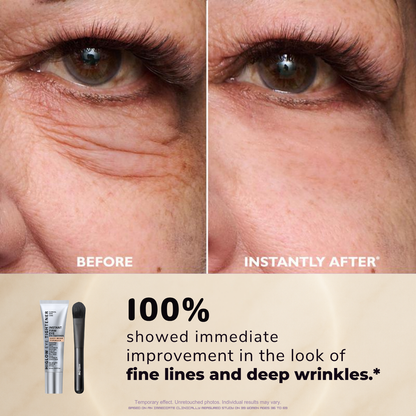 FirmX™ Eye Tightener