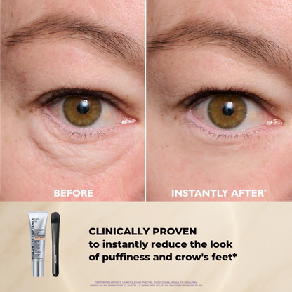 FirmX™ Eye Tightener