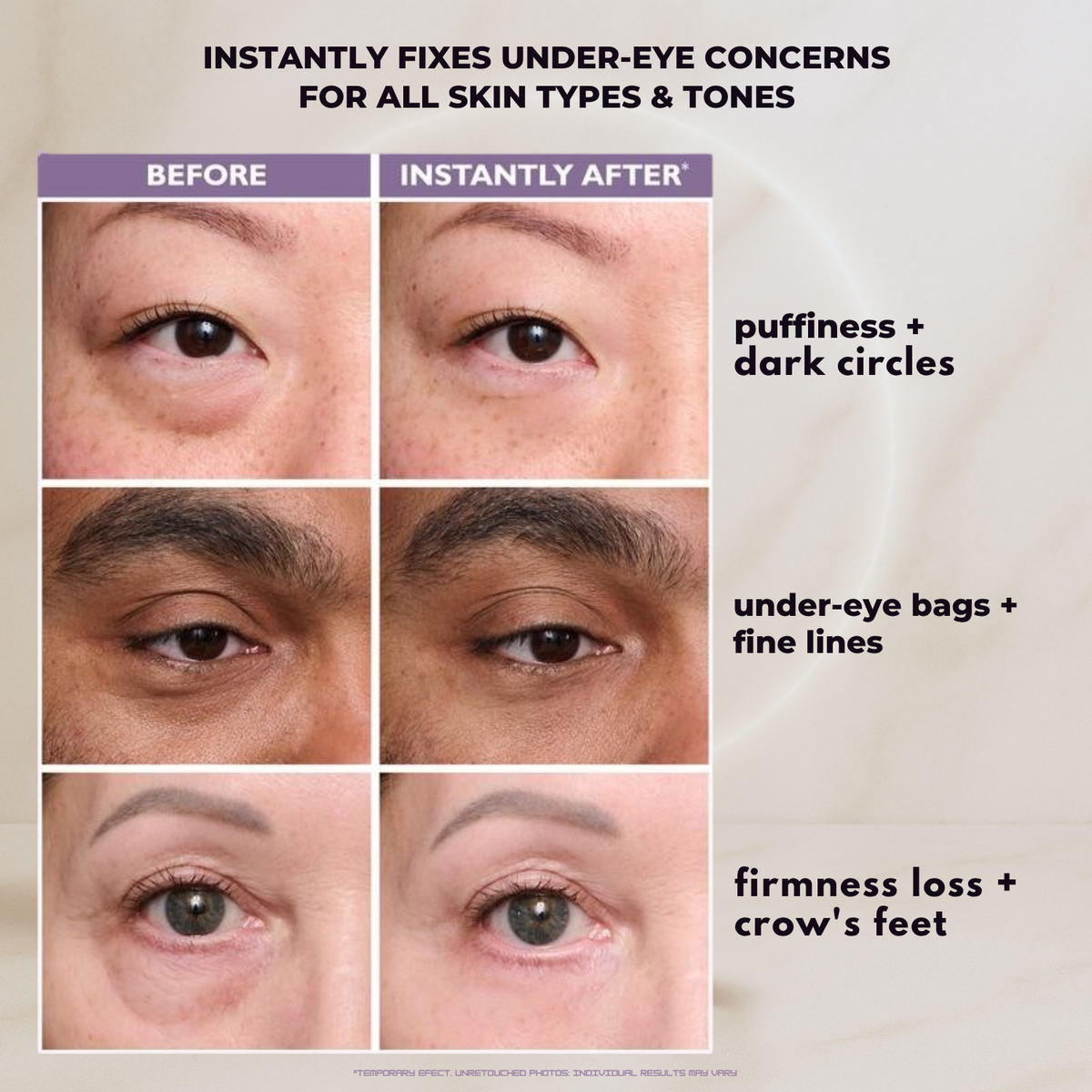 FirmX™ Eye Tightener