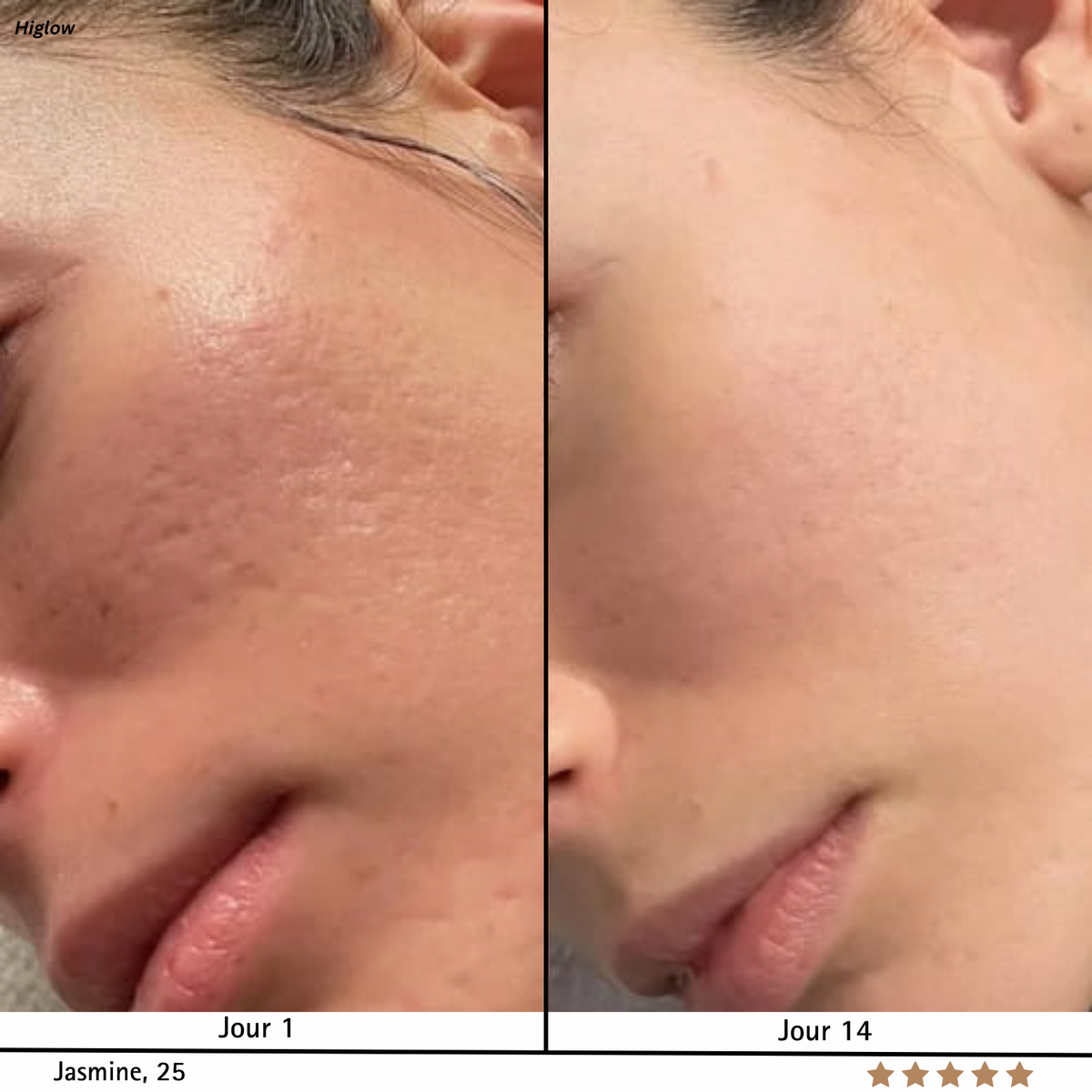 SkinRegen™ Microneedling Kit