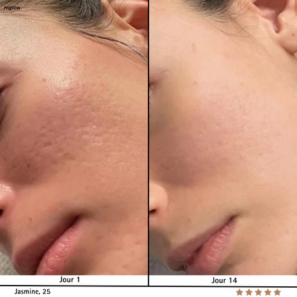 SkinRegen™ Microneedling Kit