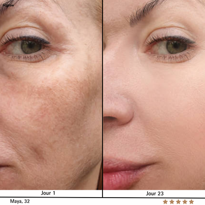 SkinRegen™ Microneedling Kit