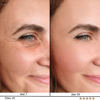 SkinRegen™ Microneedling Kit