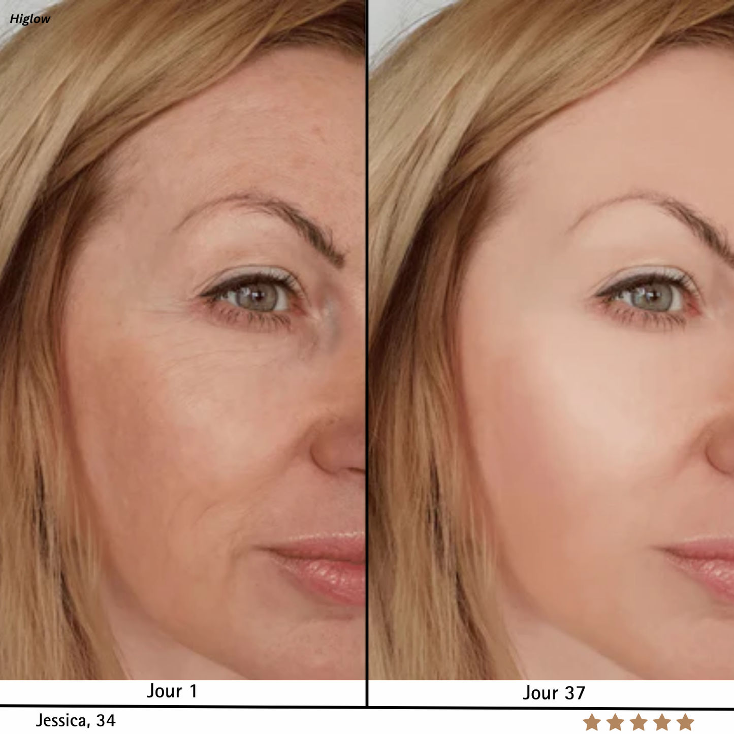 SkinRegen™ Microneedling Kit