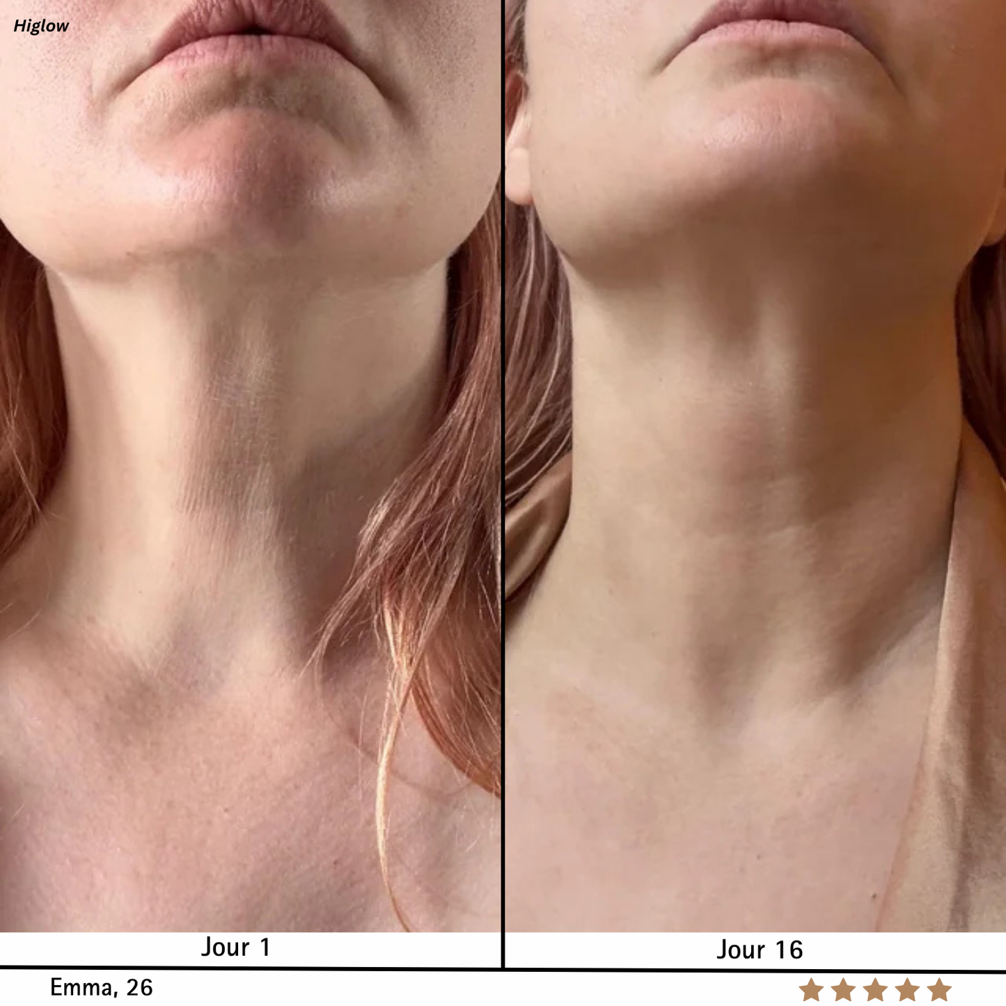 SkinRegen™ Microneedling Kit