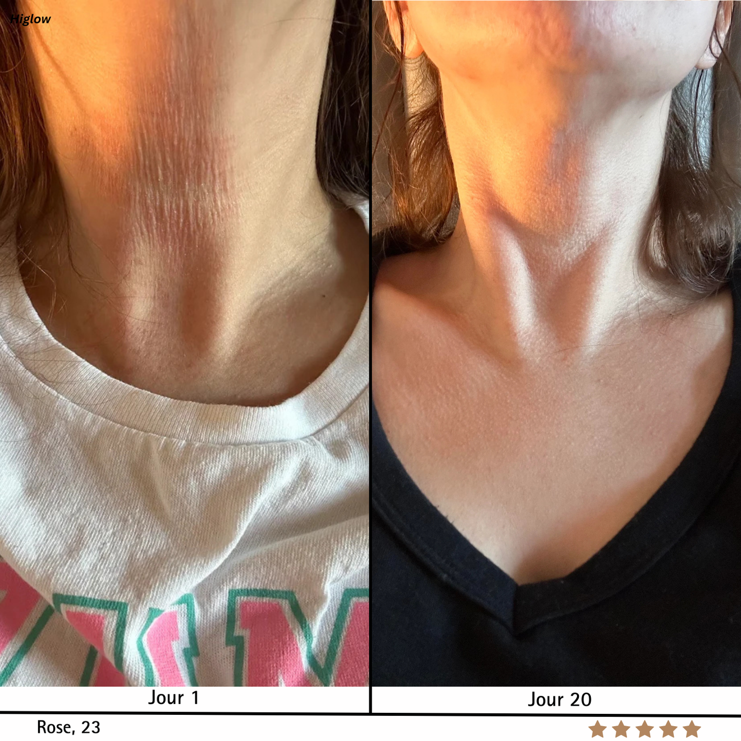 SkinRegen™ Microneedling Kit