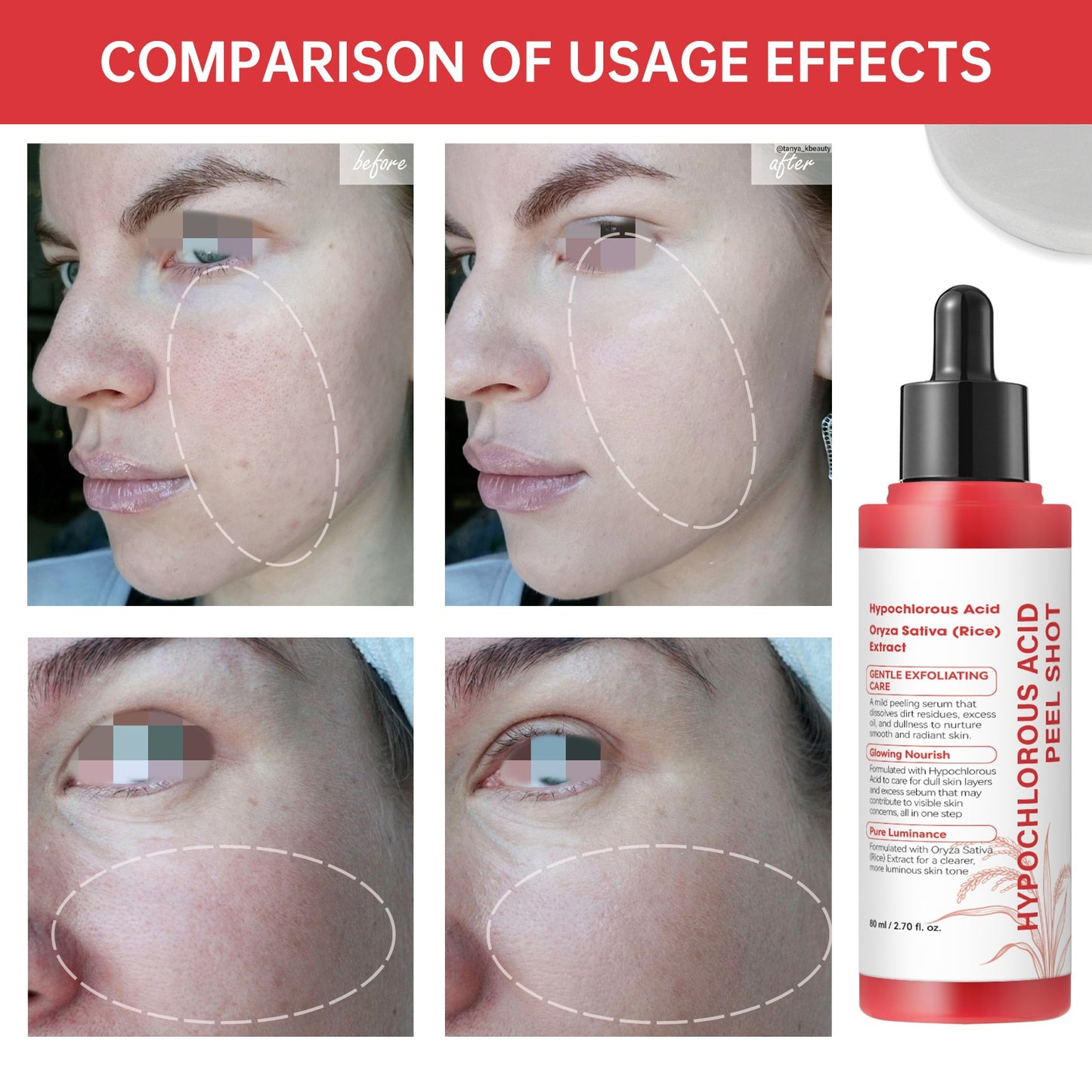 PureGlow™ Exfoliating Serum