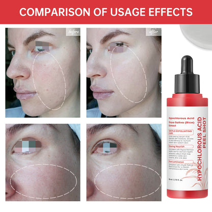 PureGlow™ Exfoliating Serum