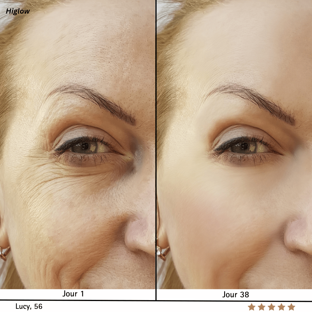 Higlow Dermalift™ - My Store