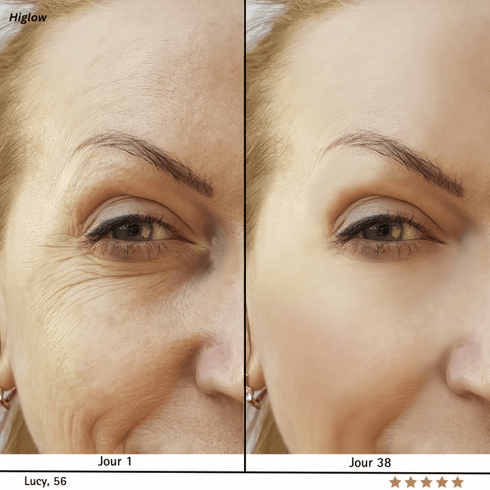 Higlow Dermalift™ - My Store