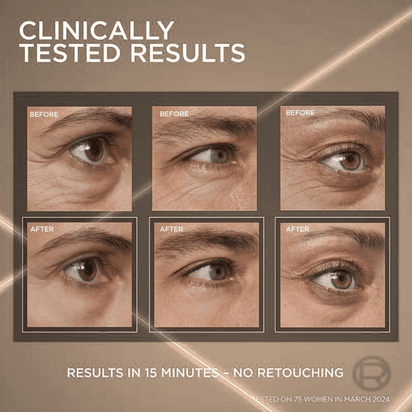 Higlow Eye Lift - My Store