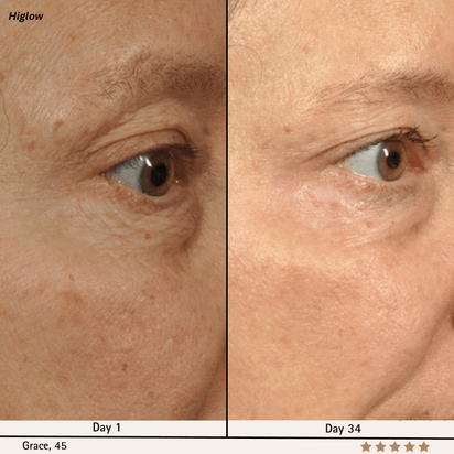 Higlow Facial Sculptor - My Store