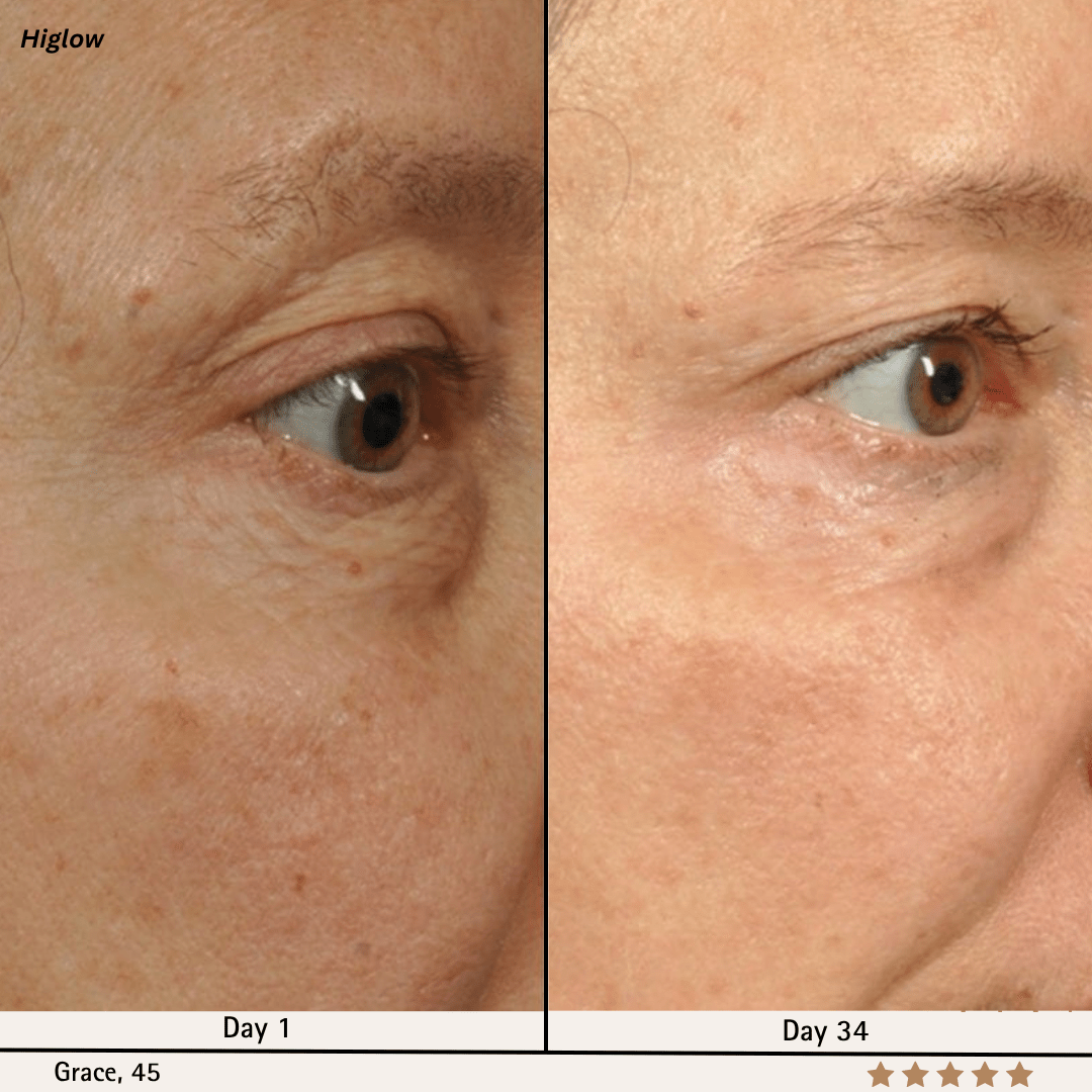 Higlow Facial Sculptor - My Store