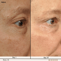 Higlow Facial Sculptor - My Store