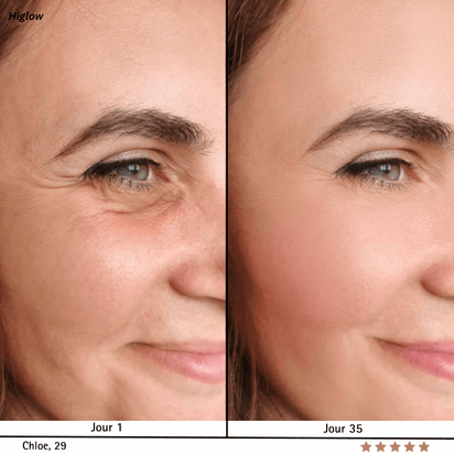 Higlow Facial Sculptor - My Store