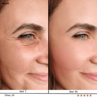 Higlow Facial Sculptor - My Store