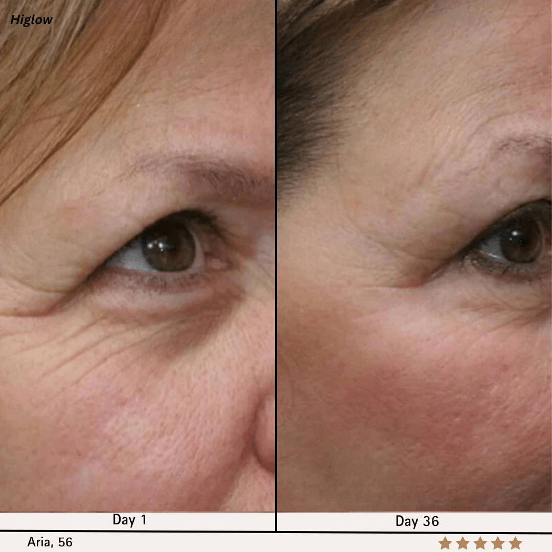 Higlow Facial Sculptor - My Store