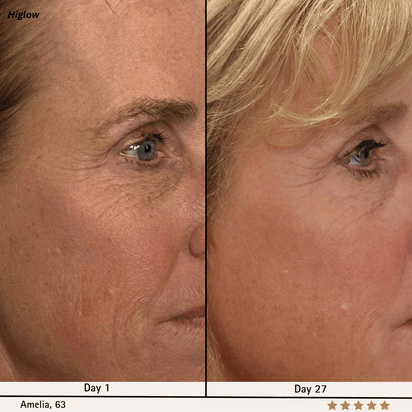 Higlow Facial Sculptor - My Store