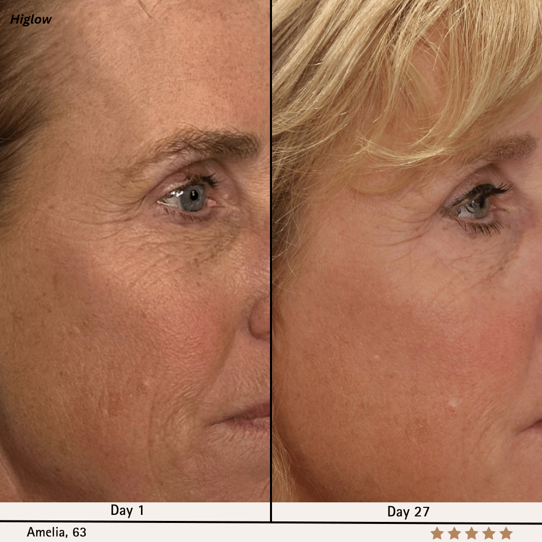 Higlow Facial Sculptor - My Store