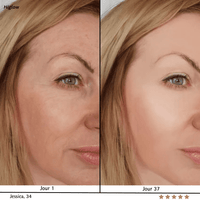 Higlow Facial Sculptor - My Store