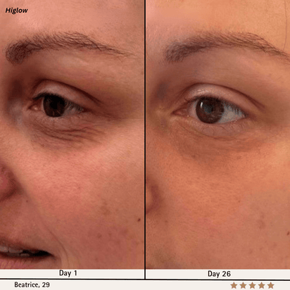 Higlow Facial Sculptor - My Store