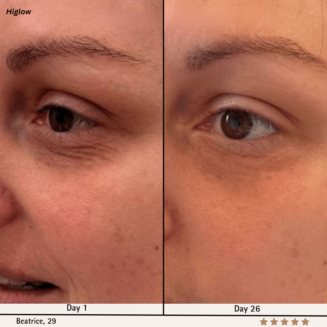 Higlow Facial Sculptor - My Store