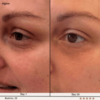 Higlow Facial Sculptor - My Store