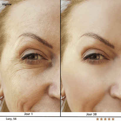 Higlow Insta Firmer™ - My Store