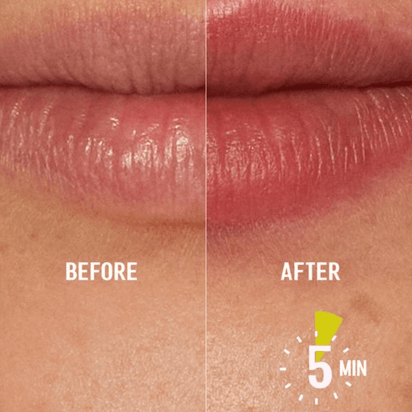 Higlow Lip Plumper™ - My Store