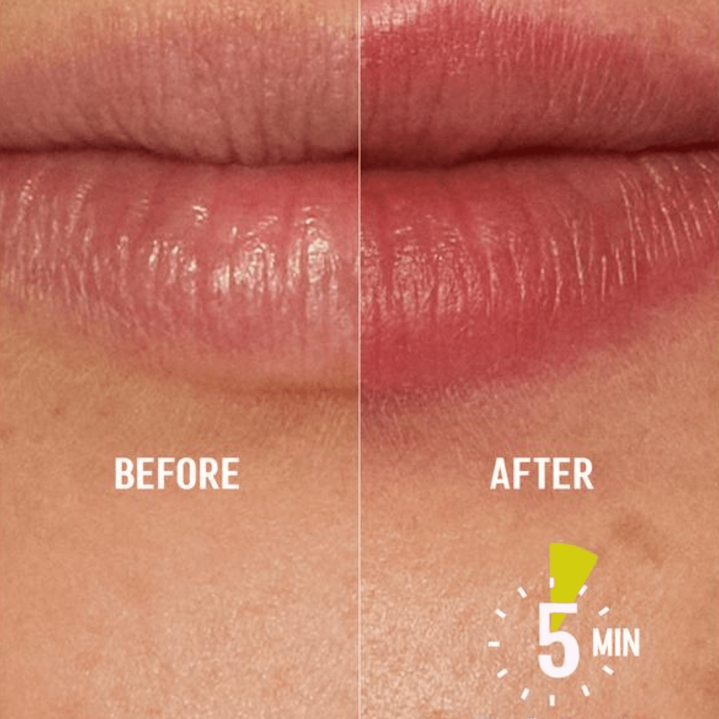 Higlow Lip Plumper™ - My Store