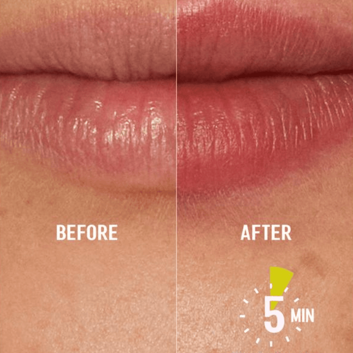 Higlow Lip Plumper™ - My Store