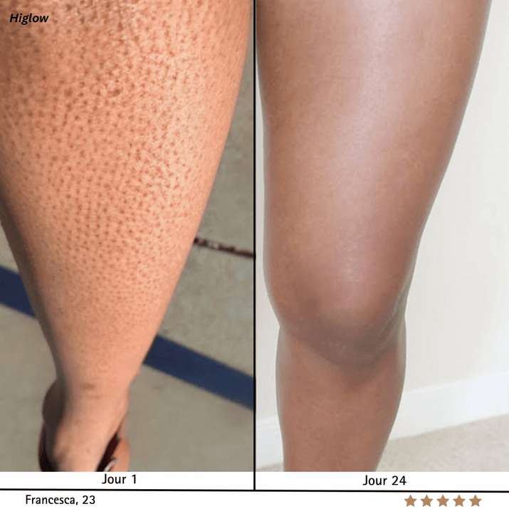 Higlow Peel Shot - My Store