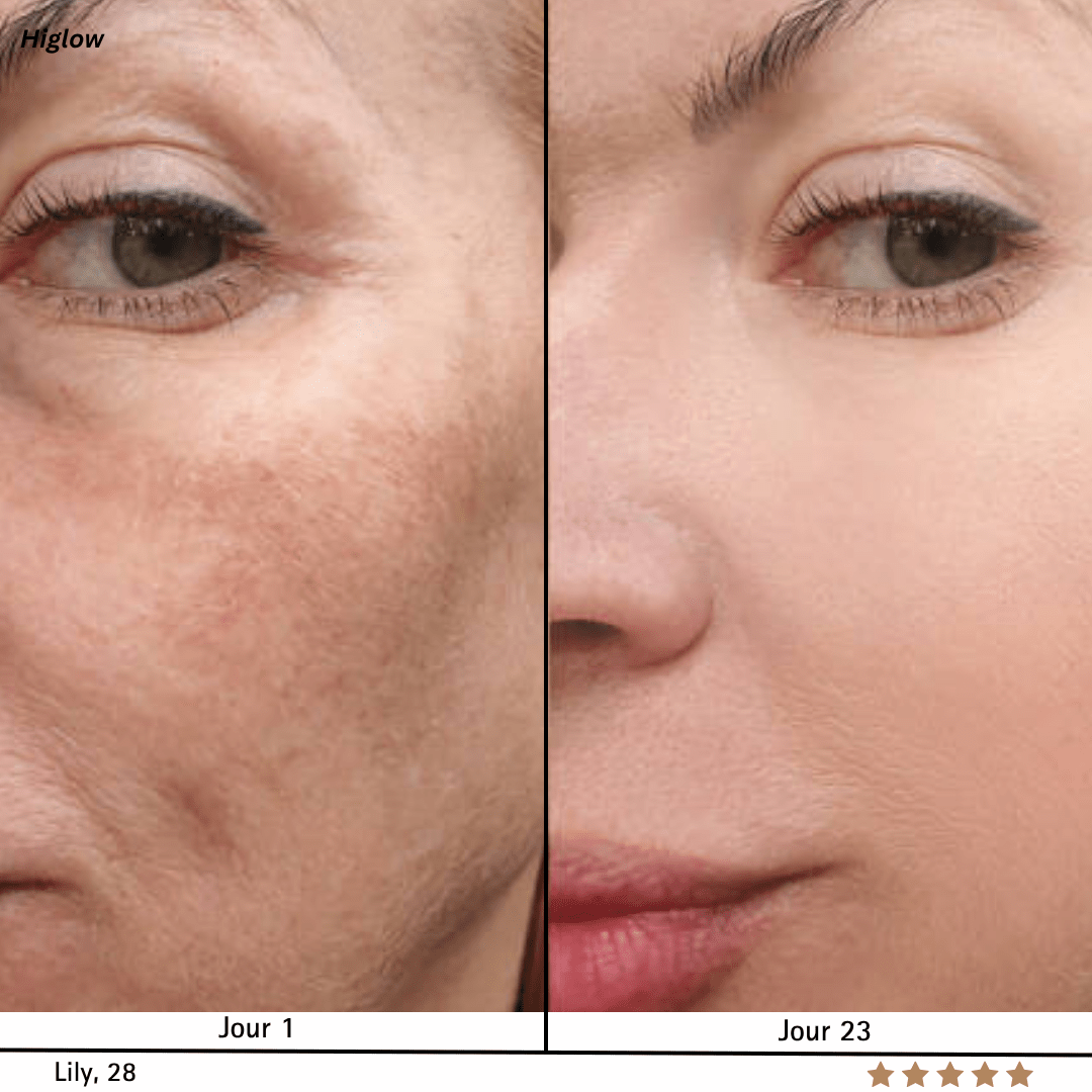 Higlow Peel Shot - My Store