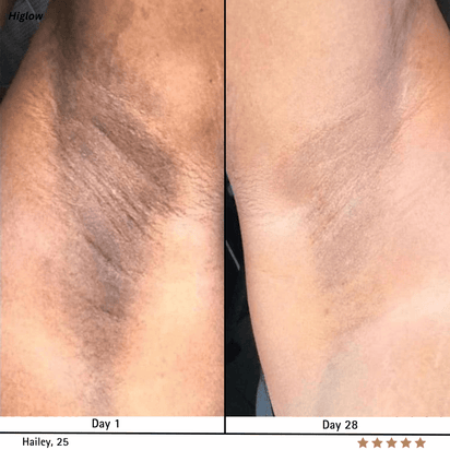 Higlow Peel Shot - My Store