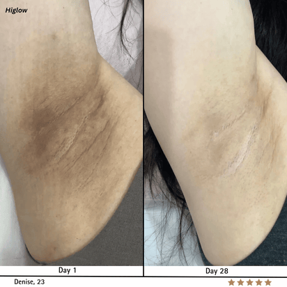 Higlow Peel Shot - My Store