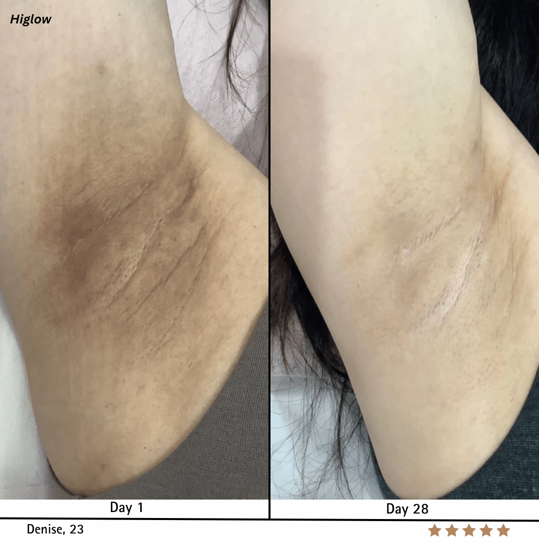 Higlow Peel Shot - My Store