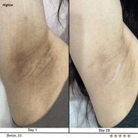 Higlow Peel Shot - My Store