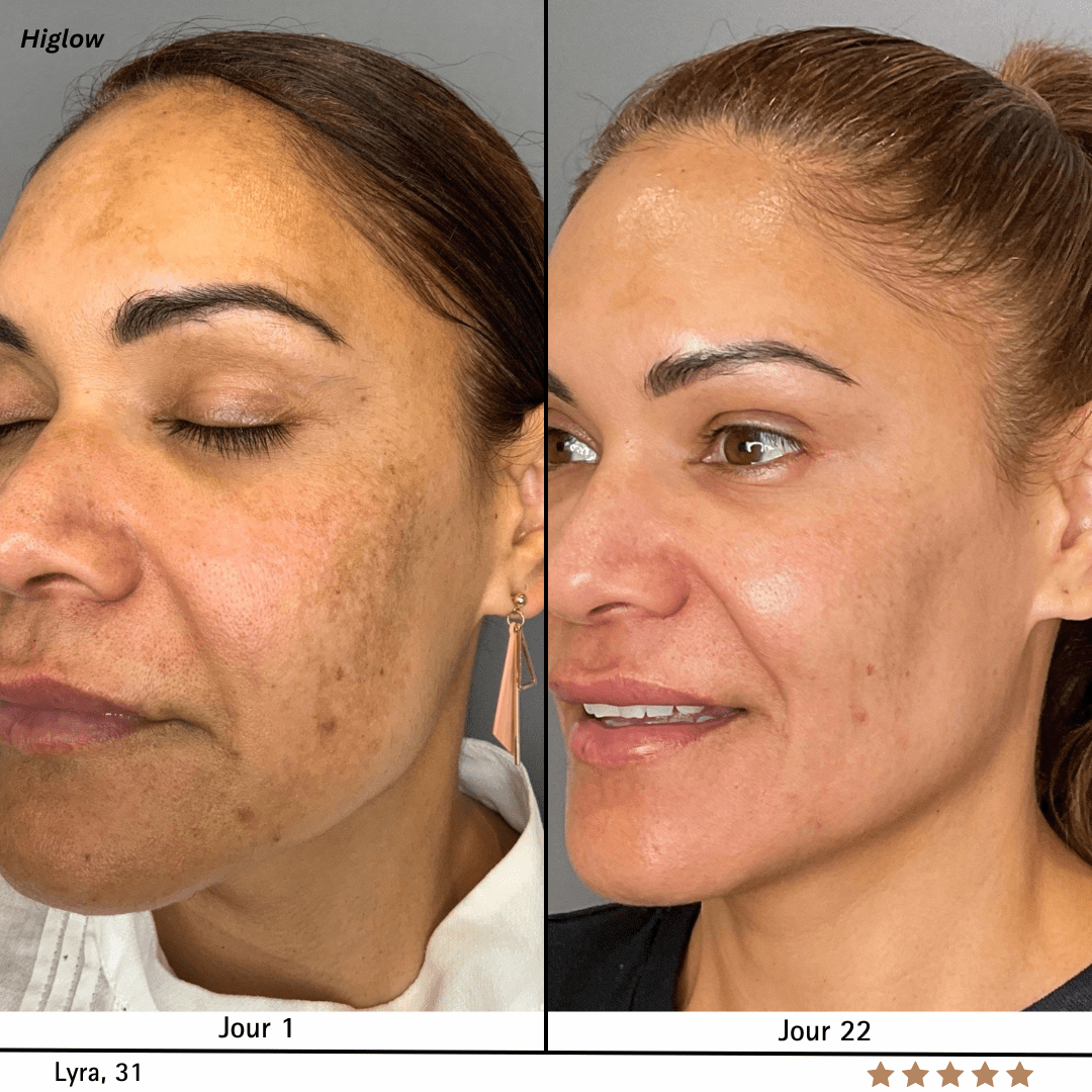 Higlow Peel Shot - My Store