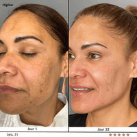 Higlow Peel Shot - My Store