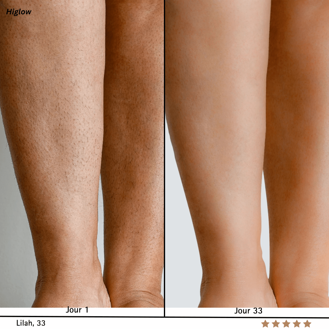 Higlow Peel Shot - My Store