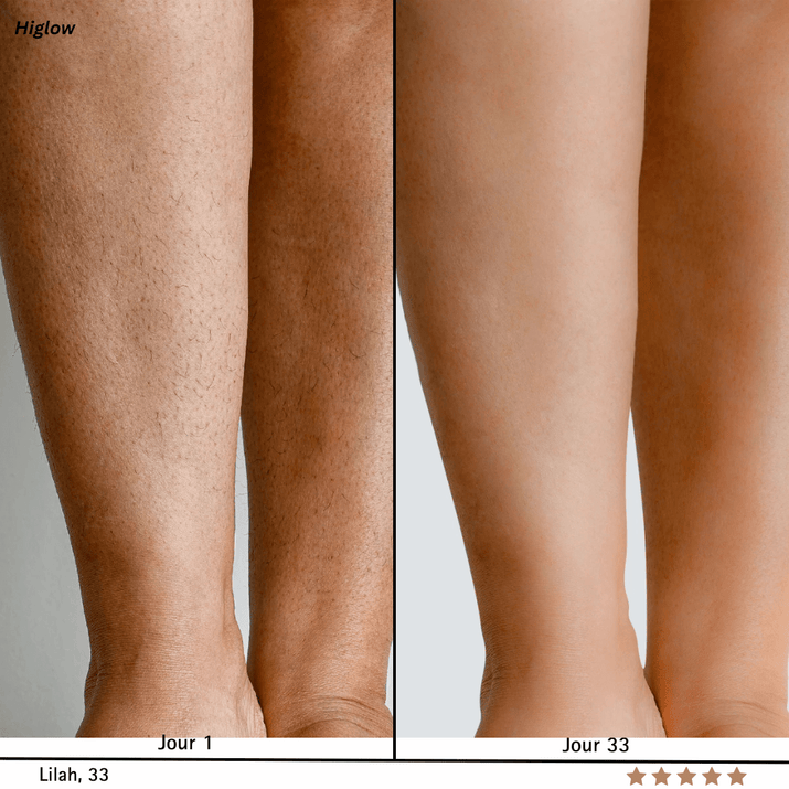 Higlow Peel Shot - My Store