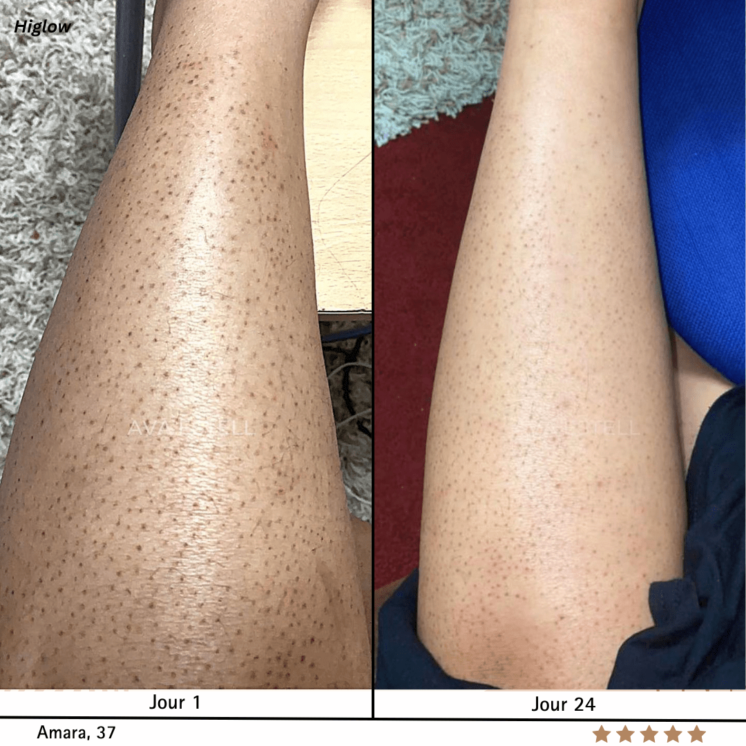 Higlow Peel Shot - My Store