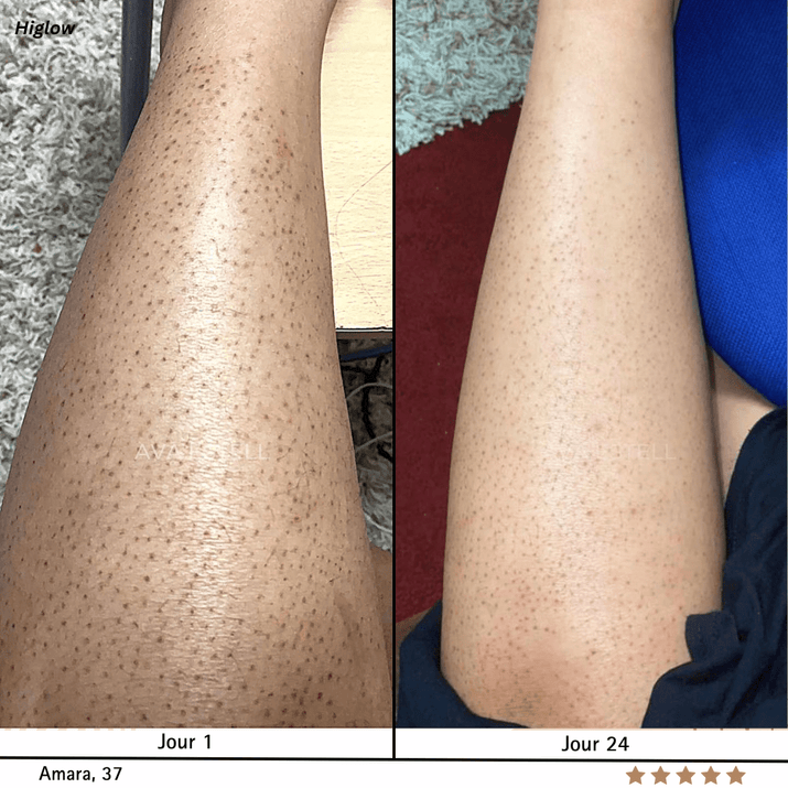 Higlow Peel Shot - My Store