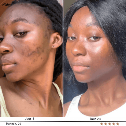 Higlow Peel Shot - My Store