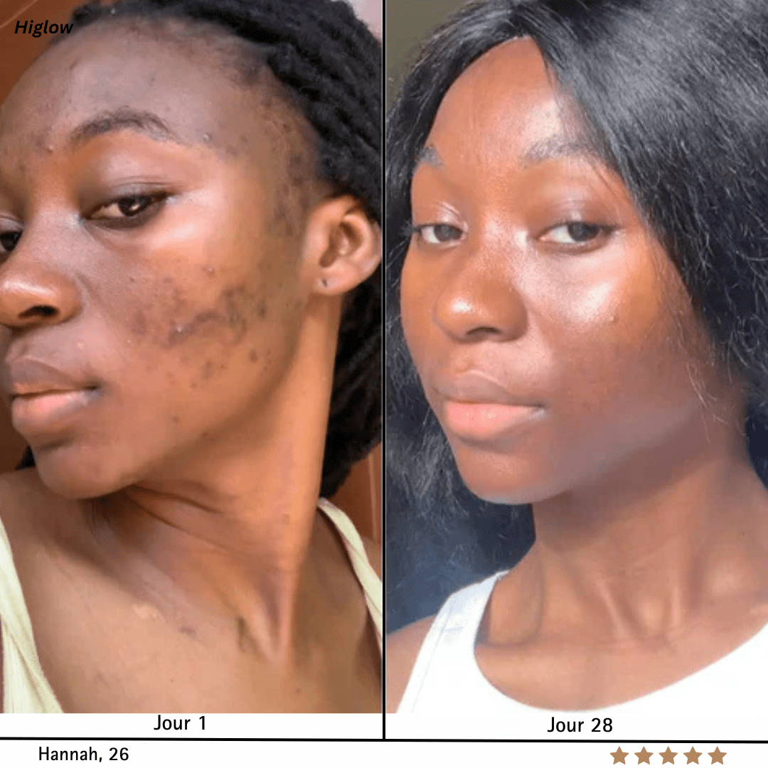 Higlow Peel Shot - My Store