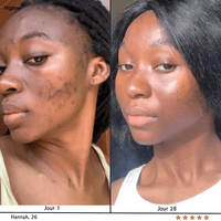 Higlow Peel Shot - My Store