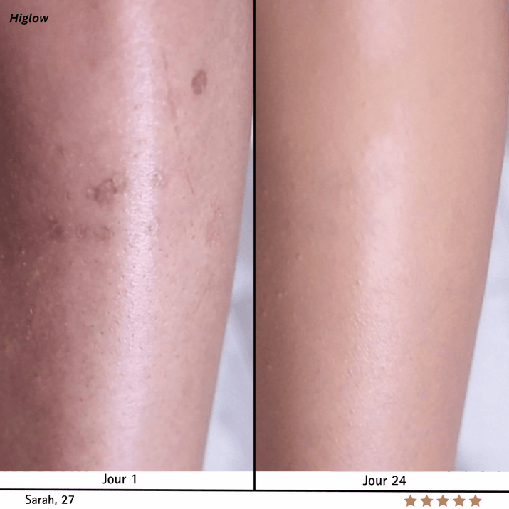 Higlow Peel Shot - My Store