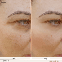 Higlow Peptide Eye Patch - My Store